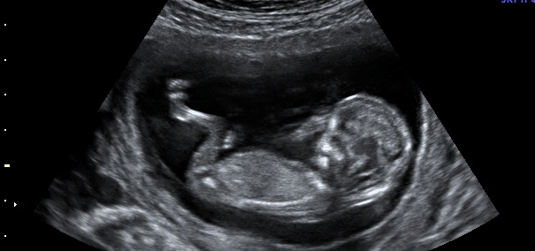 Huggies Propose Aux Futures Meres Aveugles D Imaginer Le Visage De Leur Bebe Boutique Eco Bebe Huggies Propose Aux Futures Meres Aveugles D Imaginer Le Visage De Leur Bebe Boutique Eco Bebe